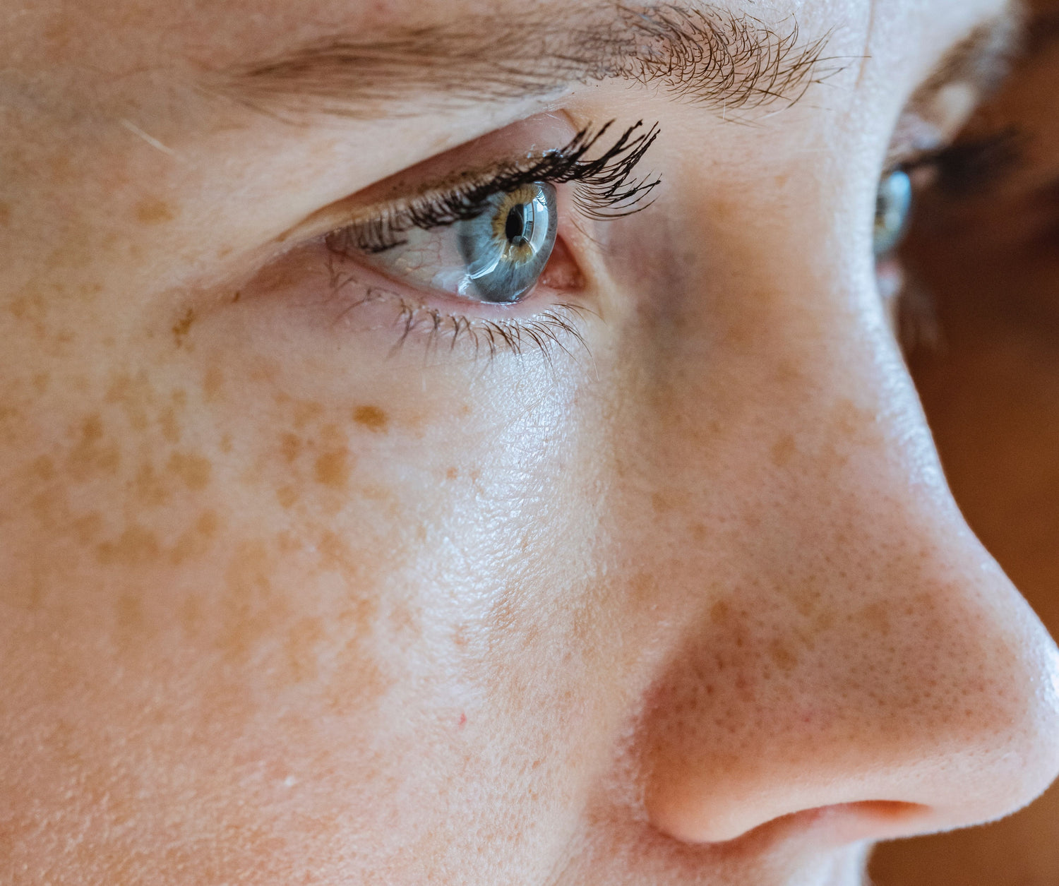 Große Poren im Gesicht – was tun?